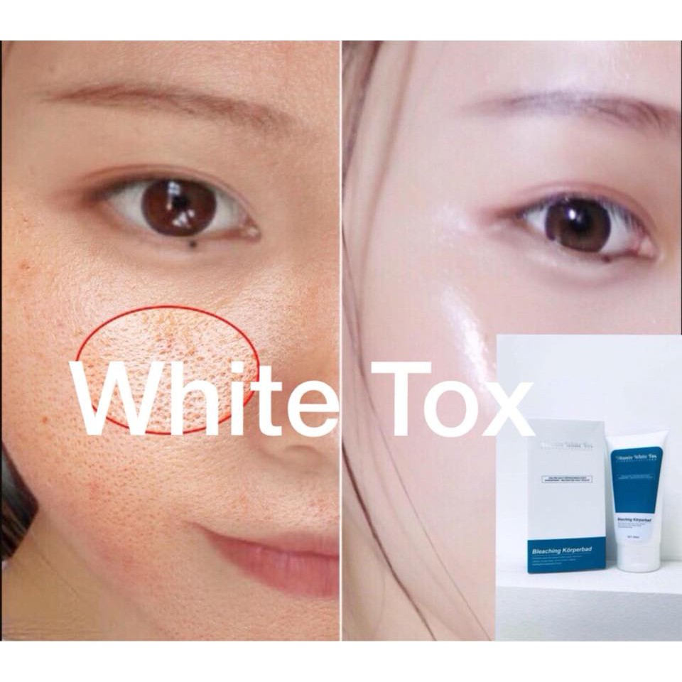 Tắm trắng Vitamin White Tox Thụy Điển-Cam kết 100% Chính Hãng phát hiện hàng giả đền gấp 10 lần