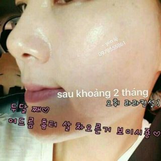 ❌❌COMBO 60 gói tinh chất vàng❌❌