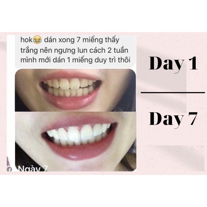 [ 1 GÓI lẻ ] Miếng dán trắng răng ❤ FREESHIP ❤ Miếng dán Crest 3D White Whitestrips [Hàng Mỹ] - trắng răng Crest