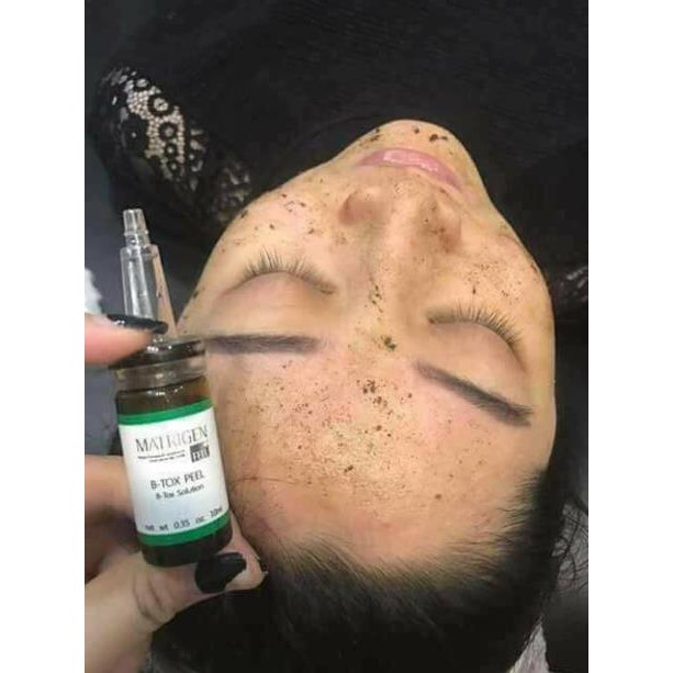 B-TOX PEEL THAY DA SINH HỌC VI TẢO HÀN QUỐC