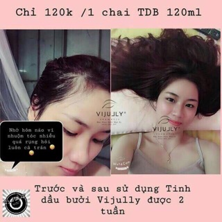 XỊT BƯỞI VYJULY