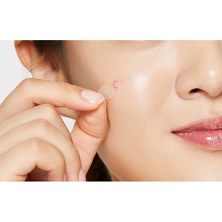 MIẾNG DÁN MỤN COSRX