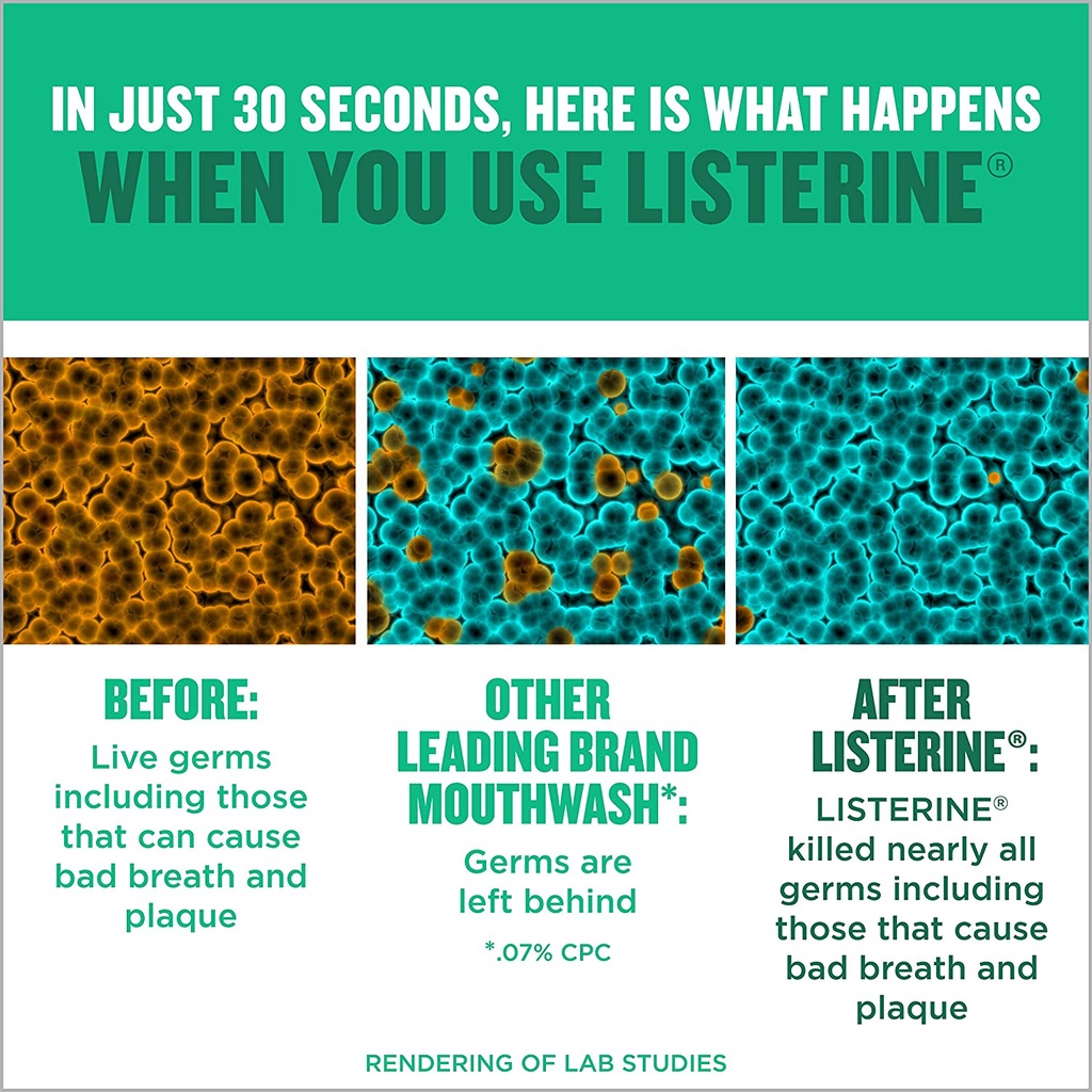 Nước súc miệng LISTERINE