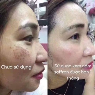 [kem nám cao cấp-seffron-hải âu việt-sạch các loại nám]