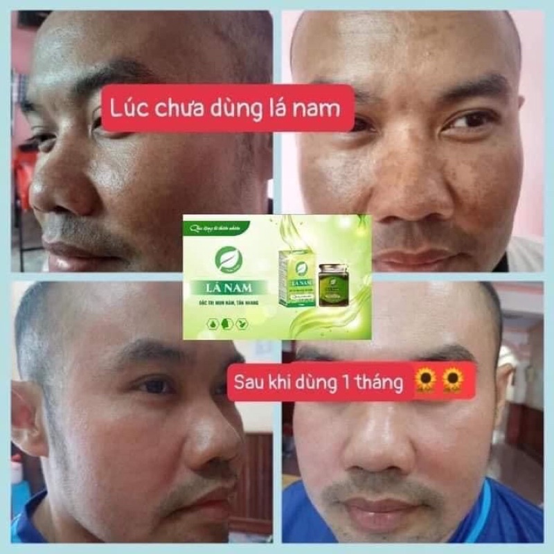 Cao Lá Nam - Xóa bỏ Nám, Tàn nhan và Thâm mụn sau 7 ngày sử dụng