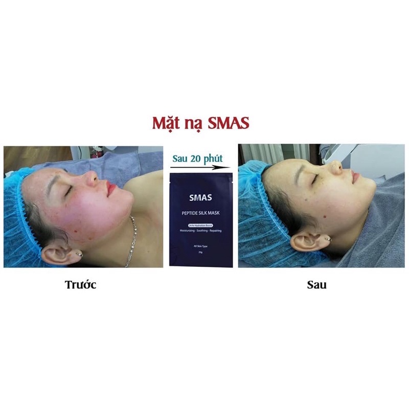 Mặt nạ phục hồi và cấp ẩm SMAS Peptide Silk Mask