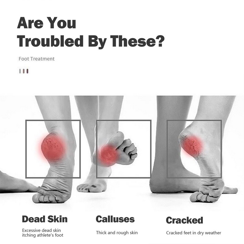 Dụng Cụ Tẩy Tế Bào Chết Cho Chân Cứng Chất Lượng Cao