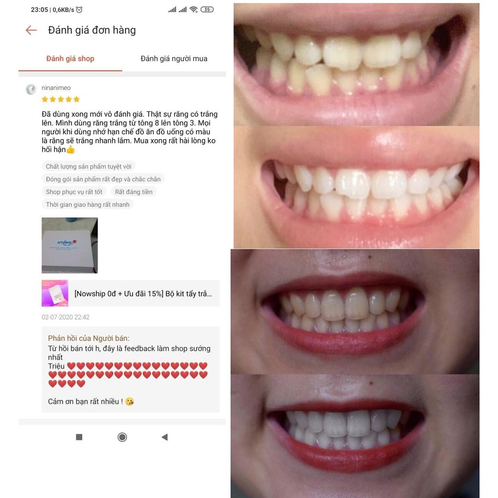 Bộ kit tẩy trắng răng Smilee - Tự làm trắng răng tại nhà chỉ 20 phút - Nhập khẩu Mỹ