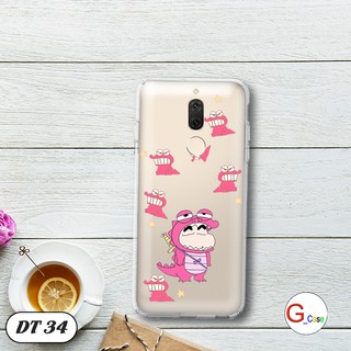 Ốp lưng dẻo cho Huawei Mate 10 Lite