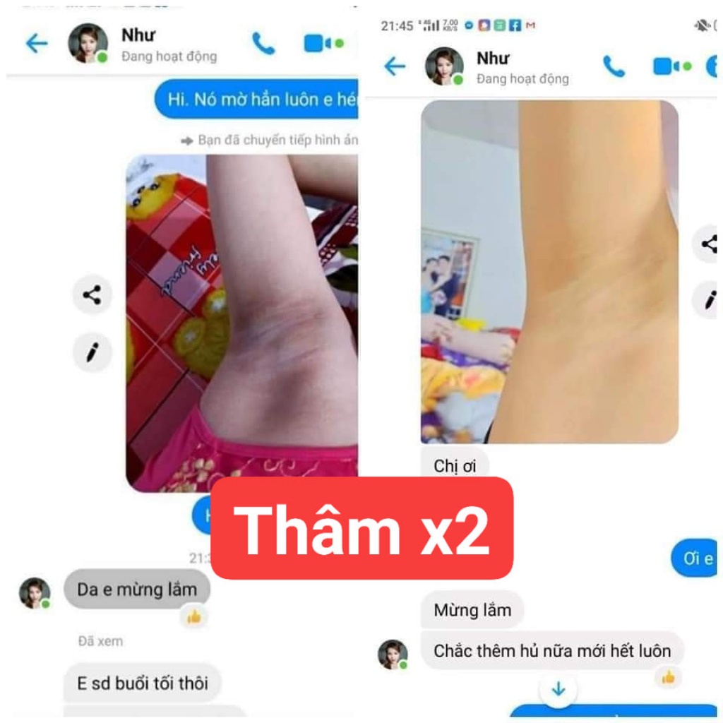 SERUM THÂM X2 HUYỀN PHI