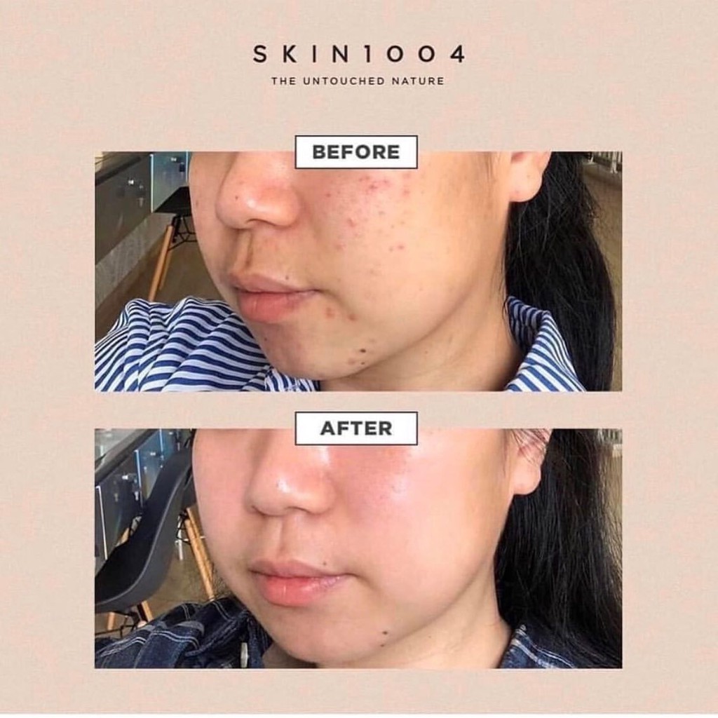 Serum rau má Madagascar Skin1004