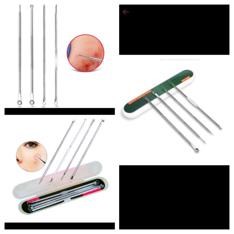 Nhíp Nặn Mụn Đầu Đen Tiện Lợi