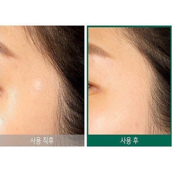 Miếng Dán Giảm Mụn Some By Mi Clear Spot Patch - 18 Miếng