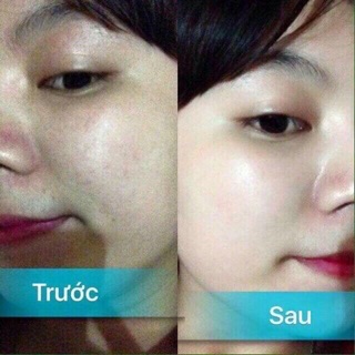 Kem dưỡng da nhật bản