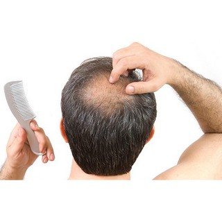 bột phủ dày tóc, làm dày tóc thưa, phủ dày đầu hói (combo bột phủ và vòi phun)