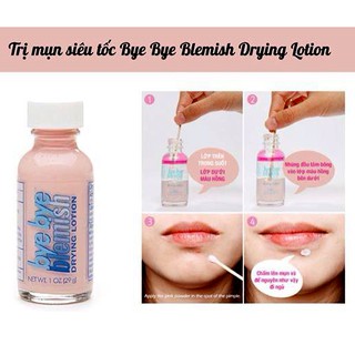 Chấm mụn Bye Bye Blemish Drying Lotion