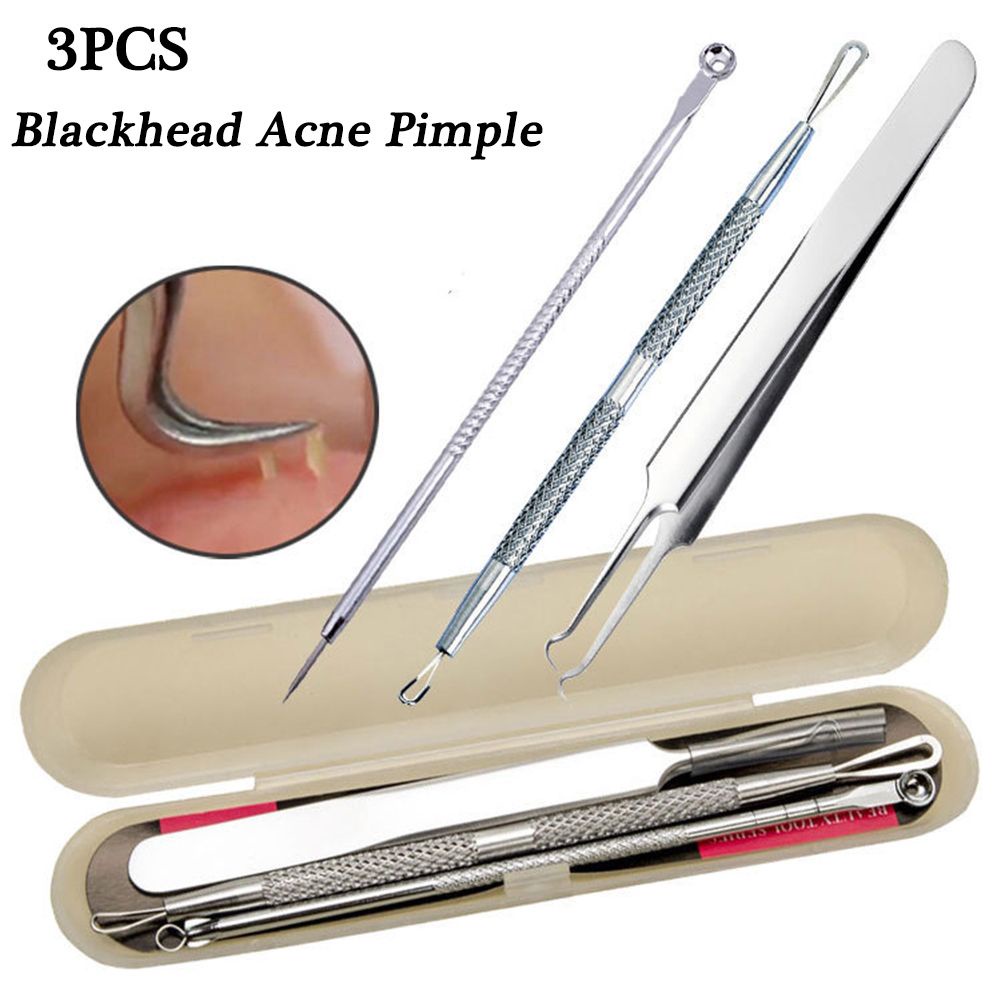 [Hàng mới về] Set 3 dụng cụ nặn mụn bằng thép không gỉ chăm sóc da nhanh chóng tiện dụng