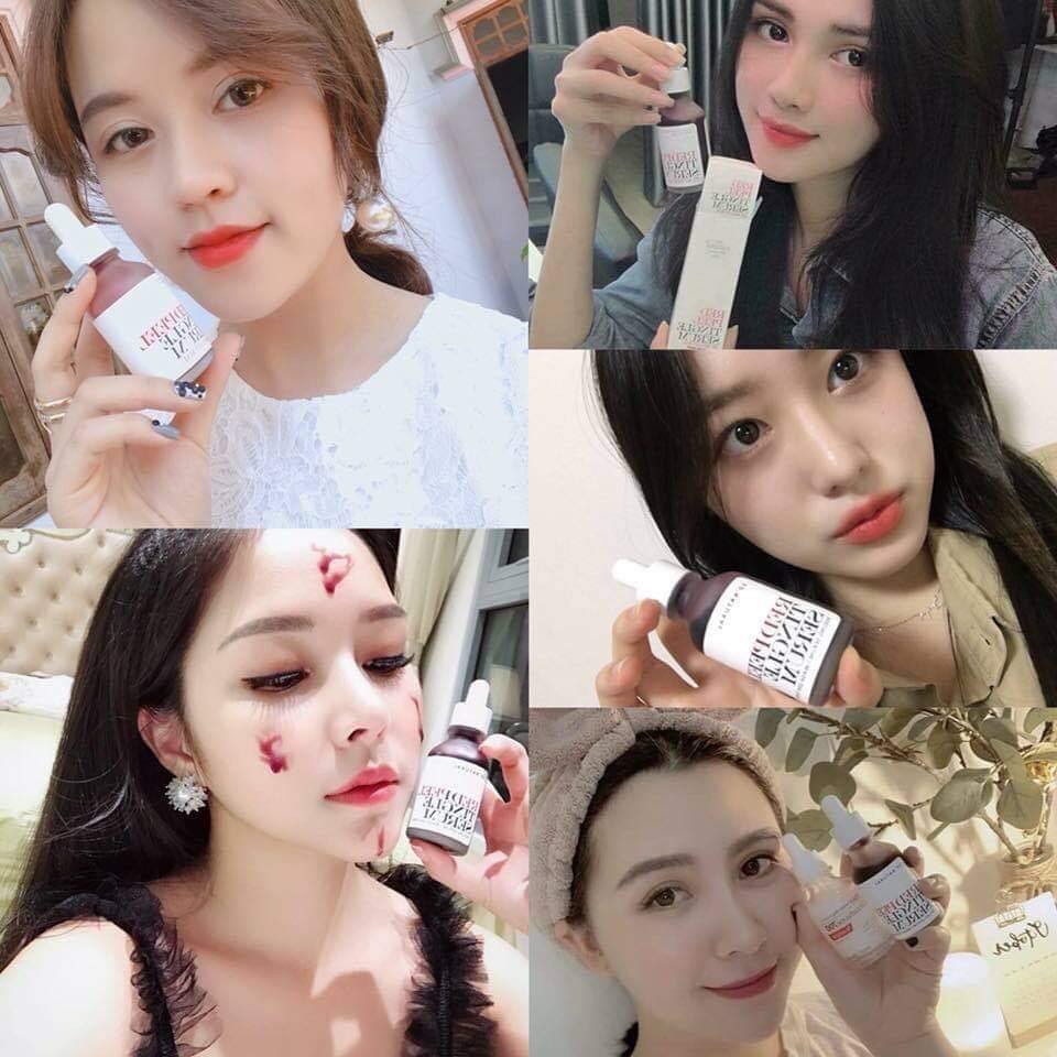 [Mã 2212FMCG100K giảm 8% đơn 500K] Sample [Gói] Red Peel Tingle Serum