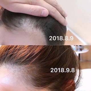 Tinh chất kích thích mọc tóc Sato Nhật Bản.