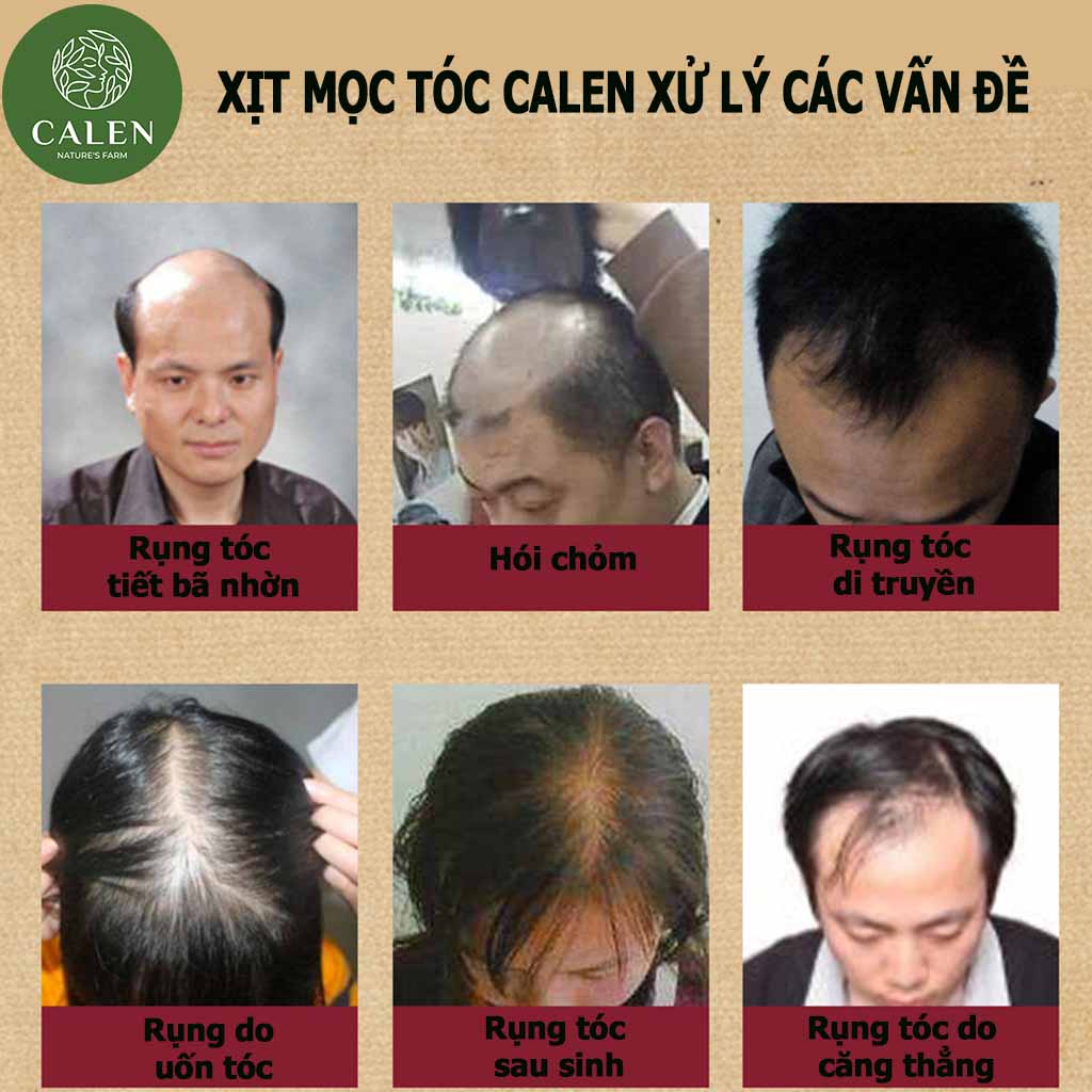Tinh Dầu Bưởi Xịt Bưởi Calen Chính Hãng Kích Mọc Tóc Dưỡng Tóc Dài Nhanh