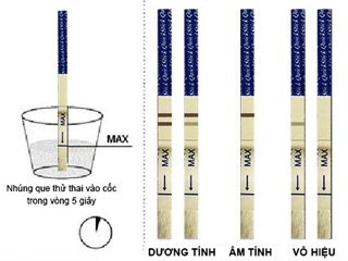 Que thử thai nhanh Quickstick (1 cái/hộp)