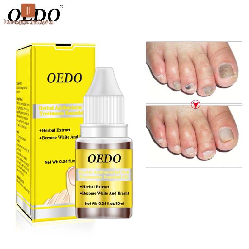 LV△ Ginseng Antibacterial Nail Treatments Essential Oil Nails Fungus Repair Foot Nail Care