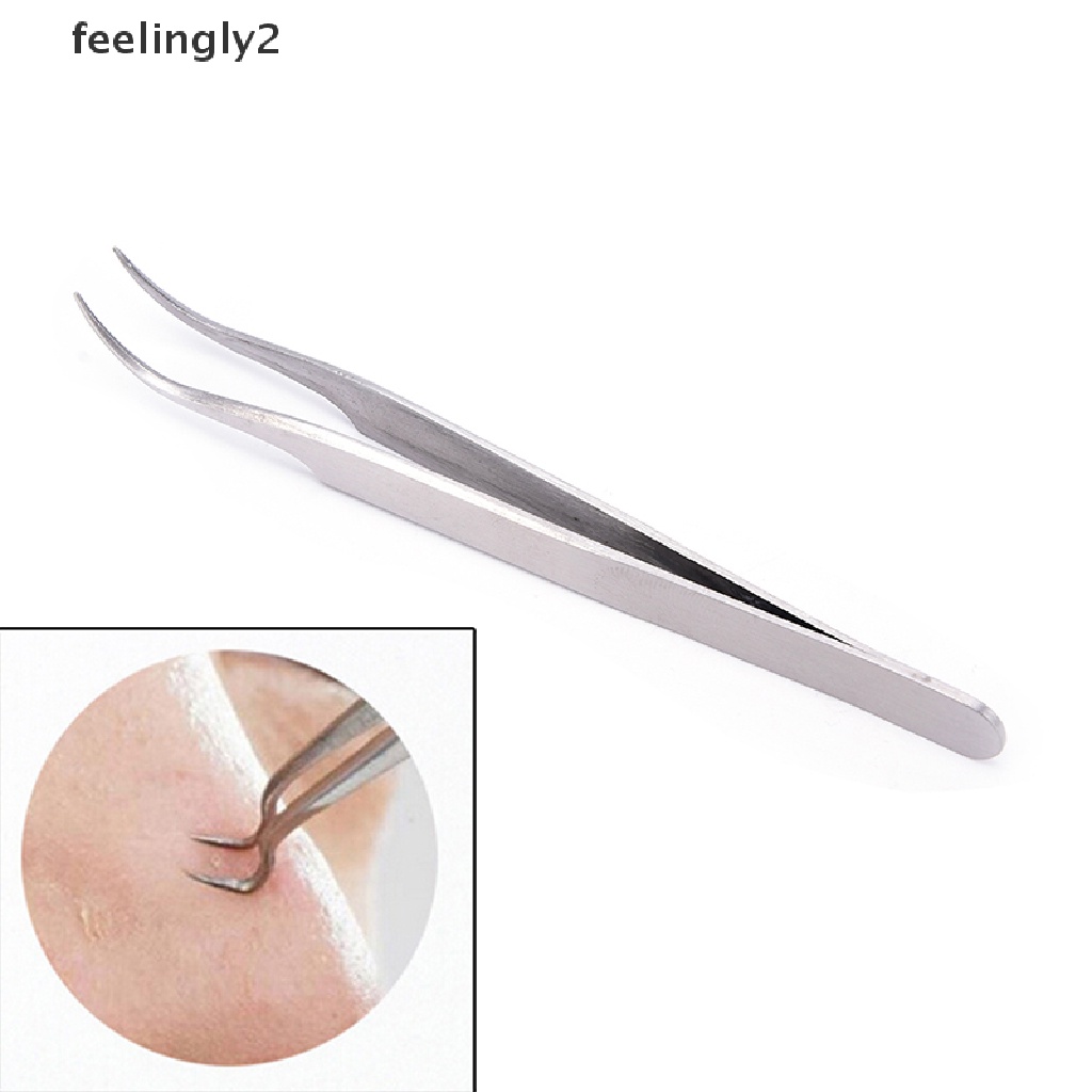 Nhíp nặn mụn đầu đen làm sạch da mặt tiện lợi