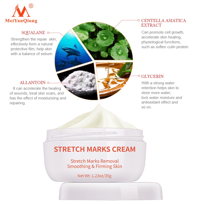 Meiyanqiong Stretch Mark Cream Làm Trắng Và Săn Chắc Mịn Mượt Chống Lão Hóa Giảm rạn da Kem dưỡng ẩm 35g