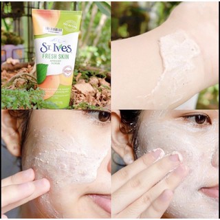 Tẩy da chết face St.Ives