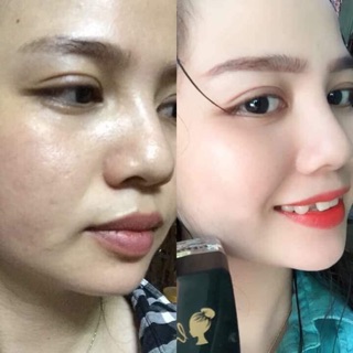 Face trắng hồng HM STORE