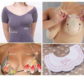 Miếng dán ti & nâng ngực Moshi