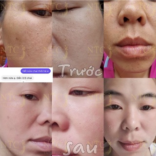 tái tạo da nhanh NTC