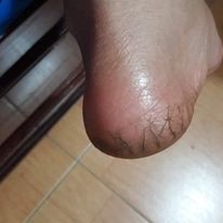 (Hộp 20 Sáp) nứt gót chân Thái Lan