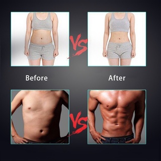 Máy Mát Xa Đốt Cháy Mỡ Thừa EMS