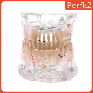2x Human Mouth Dental Teeth Pathological Model Teaching Study Tools Clear