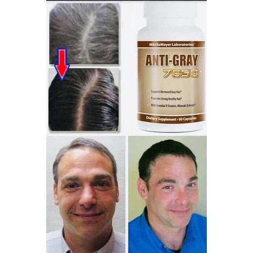 Viên Uống ANTI-GRAY 7050 Hỗ Trợ Bạc Tóc 60 Viên Mỹ