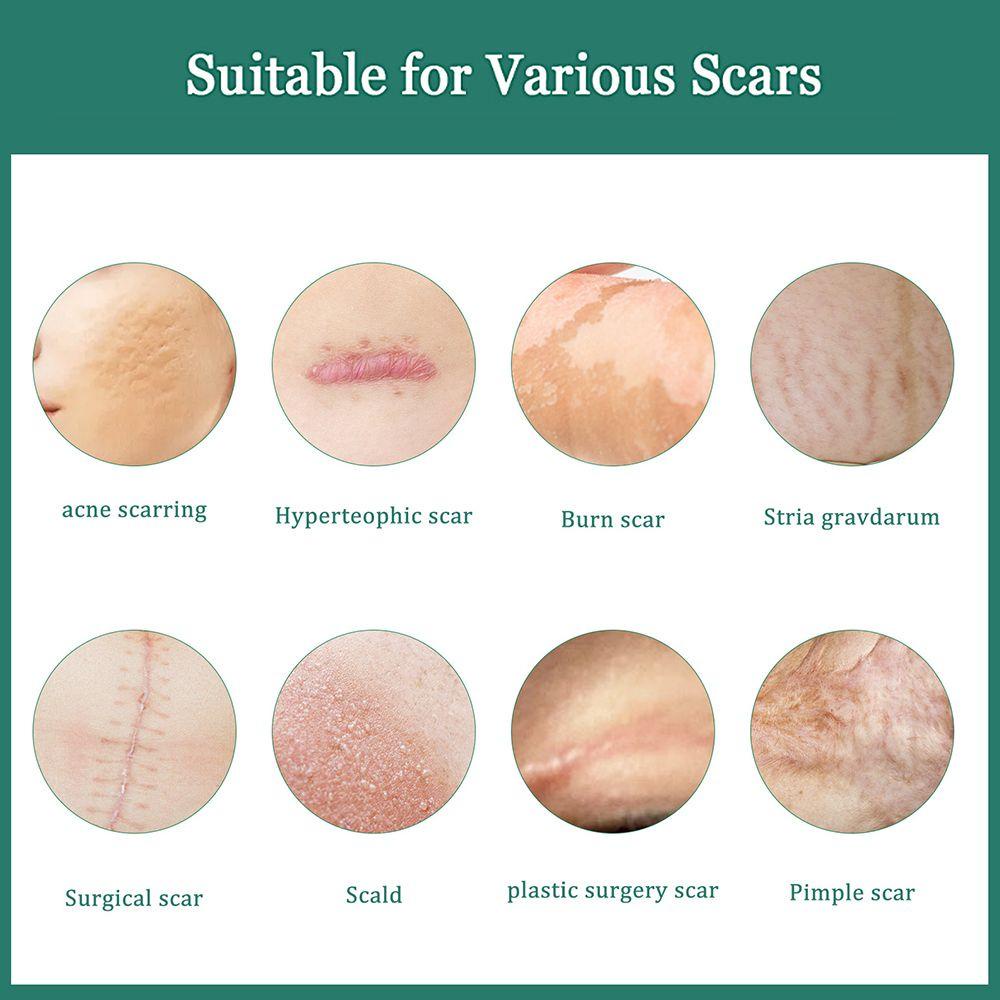 Kem Hỗ trợ giảm sẹo XIANTIN Chất Lượng Cao Tiện Dụng