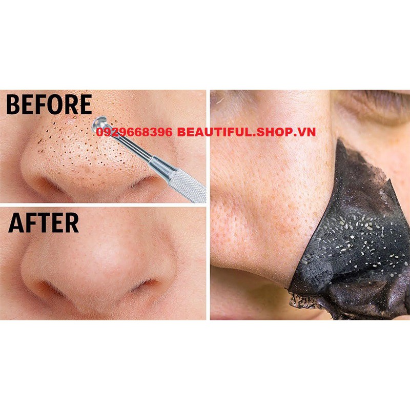 👍[100% Chính Hãng] Gel Lột Mụn Than Tre Ngân Bình (1 Lọ)_Siêu Sạch Lột Sạch Mụn Cám, Mụn Đầu Đen, Se Lỗ Chân Lông | BigBuy360 - bigbuy360.vn