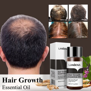Tinh dầu kích thích mọc tóc LANBENA 20ml