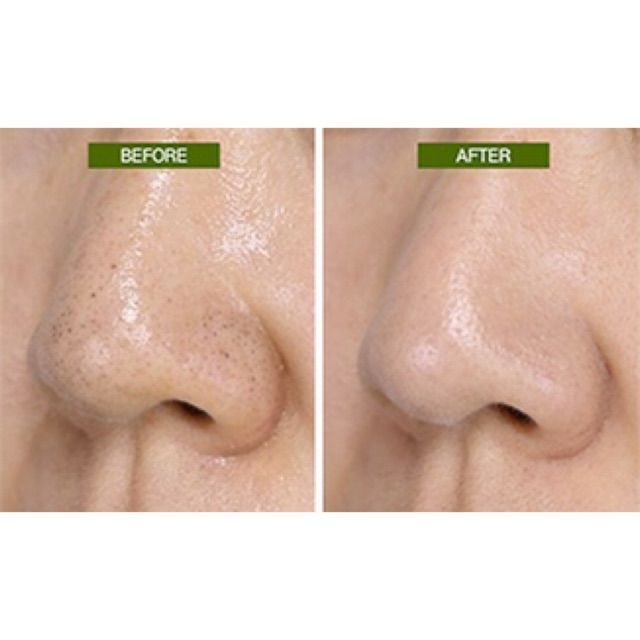 Mamonde Pore Clean Blackhead Stick - lăn mụn đầu đen | BigBuy360 - bigbuy360.vn