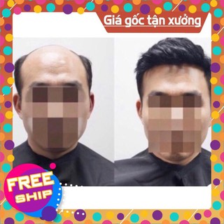 Tóc giả che hói nam