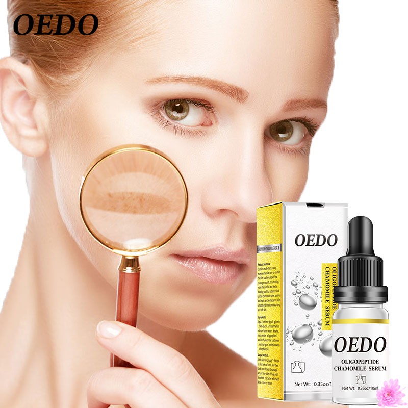 Oligopeptide Chamomile Serum OEDO Làm dịu và Phục hồi Chống nhăn Dưỡng ẩm Chăm sóc Chuyên sâu Cho Mặt 10ml