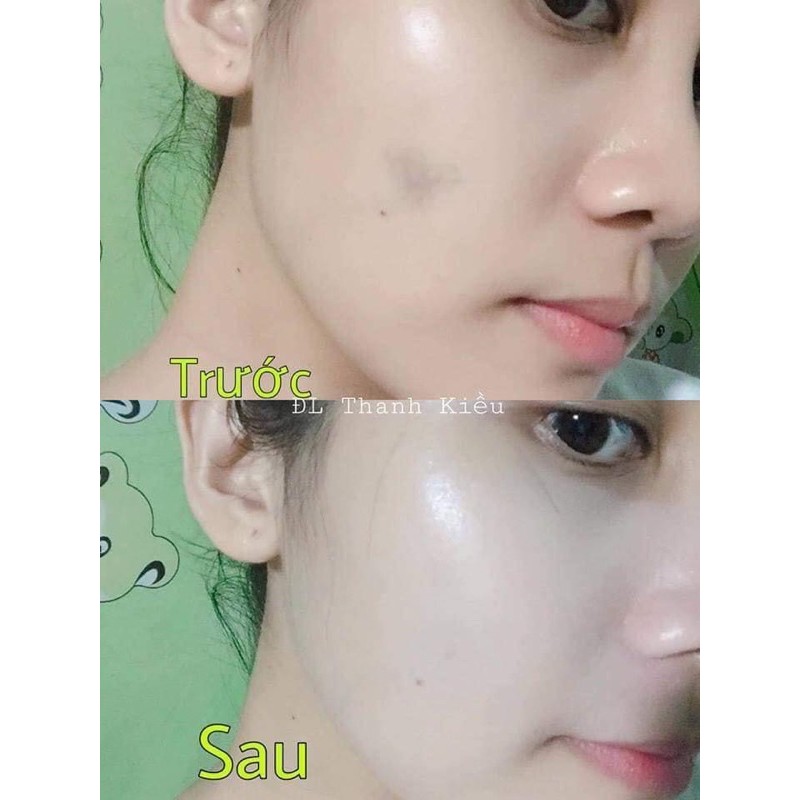 Phấn nước che khuyết điểm CENLIA 🔥[ CHÍNH HÃNG ]🔥 che sạch khuyết điểm mụn thâm, lỗ chân lông to, bền chắc không dễ trôi | BigBuy360 - bigbuy360.vn