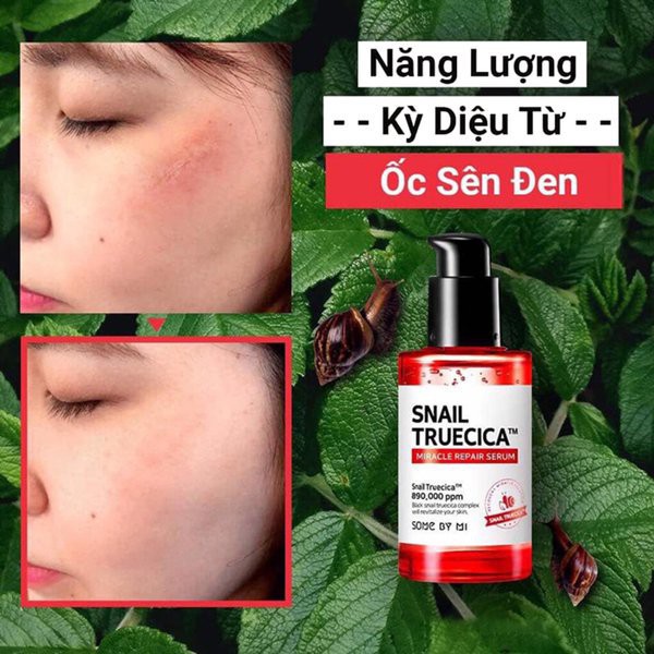 Tinh Chất Ốc Sên Phục Hồi Cải Thiện Thâm Sẹo Some By Mi Snail Truecica Miracle Repair Serum 50ml