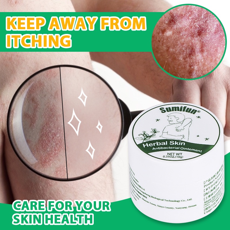 Kem bôi ngứa, người lớn, trẻ em, tinh chất thảo dược thiên nhiên