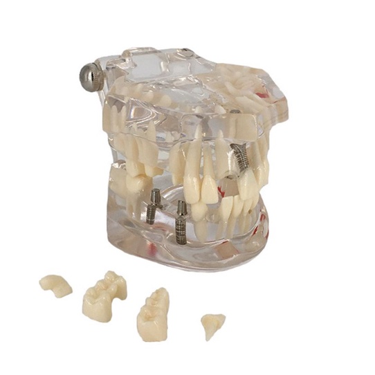 [Hàng mới về] Mô hình hàm răng đa năng chuyên dụng dành cho nha khoa