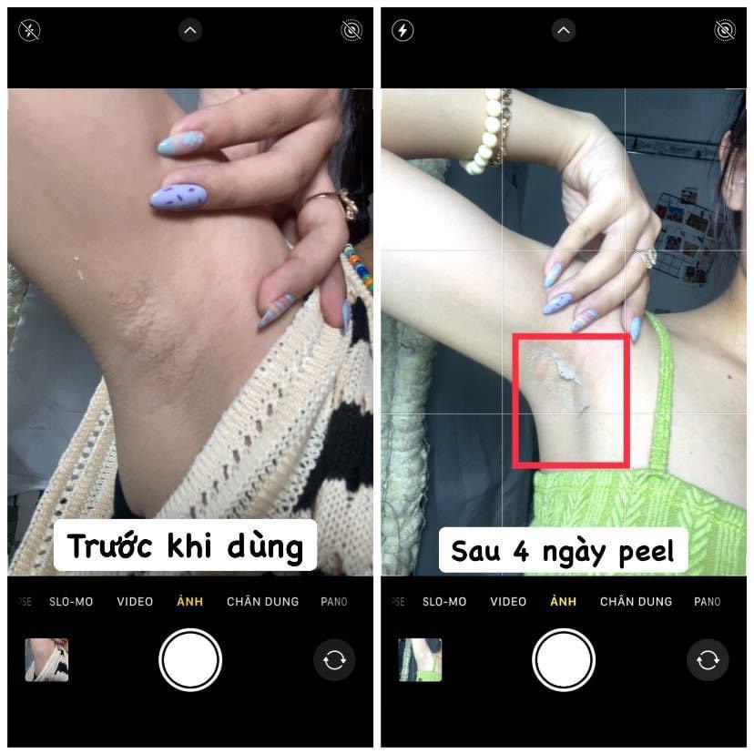 Kem Peel Body Retinol Mẫu Mới 2023 LE'PEAU, Peel Body, Trắng Da Mờ Thâm