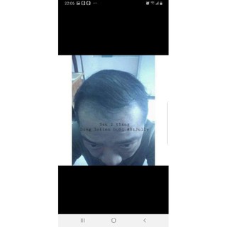 [KÍCH THÍCH MỌC TÓC 100%] TINH DẦU BƯỞI KÍCH THÍCH MỌC TOC-TRỊ RỤNG TÓC VIJULLY