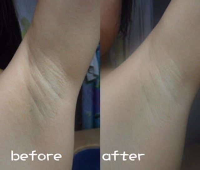 Soap trị thâm nách PELICAN | BigBuy360 - bigbuy360.vn