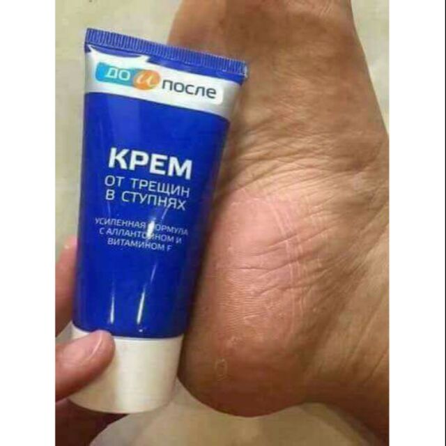 Kem trị nứt nẻ chân Nga BQ